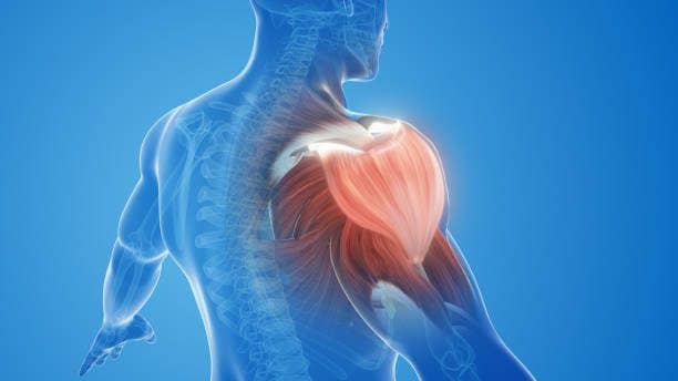 contractura muscular en hombro